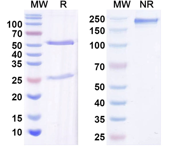 SDS-PAGE for Anti-GluN2C/NR2C glutamate receptor Antibody (N422/76)