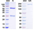SDS-PAGE for Anti-GluN2C/NR2C glutamate receptor Antibody (N464A/94)