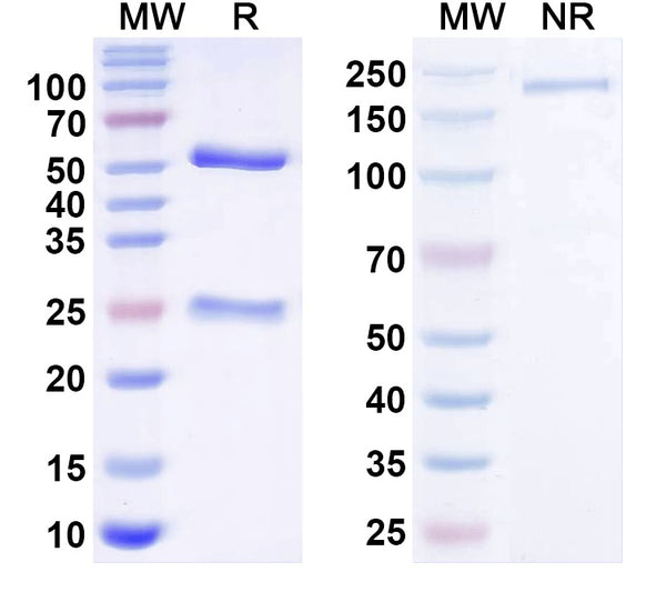 SDS-PAGE for Anti-GluN2C/NR2C glutamate receptor Antibody (N464A/94)