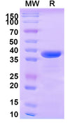 Recombinant Human CD148/PTPRJ Protein, N-His