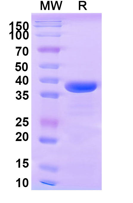 Recombinant Human CD148/PTPRJ Protein, N-His