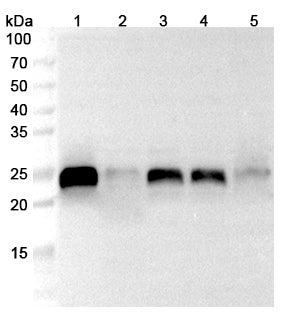 Western blot analysis was performed using anti-PRDX1 polyclonal antibody at 1μg/ml on various samples.
Lane 1: HepG2 cell lysate
Lane 2: A549 cell lysate
Lane 3: MCF7 cell lysate
Lane 4: Jurkat cell lysate
Lane 5: Mouse kidney lysate