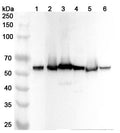 Western blot analysis was performed using anti-BECN1 polyclonal antibody at 1ug/mL on various samples.
Lane 1: MCF-7 cell lysate
Lane 2: Mouse testis lysate
Lane 3: Mouse brain lysate
Lane 4: Mouse lung lysate
Lane 5: Rat testis lysate