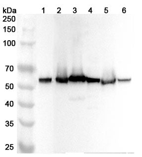 Western blot analysis was performed using anti-BECN1 polyclonal antibody at 1ug/mL on various samples.
Lane 1: MCF-7 cell lysate
Lane 2: Mouse testis lysate
Lane 3: Mouse brain lysate
Lane 4: Mouse lung lysate
Lane 5: Rat testis lysate