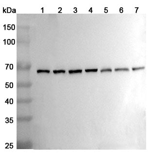 Western blot analysis was performed using anti-Beclin-1 polyclonal antibody at 1ug/mL on various samples.
Lane 1: Jurkat cell lysate
Lane 2: Mouse testis lysate
Lane 3: Mouse brain lysate
Lane 4: Mouse lung lysate
Lane 5: Rat testis lysate
Lane 6: Rat brain lysate
Lane 7: Rat lung lysate