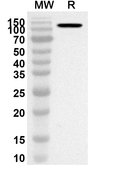 Western blot analysis was performed using anti-Human LAMC2 polyclonal antibody at 1ug/mL on recombinant Human LAMC2 (Catalog No. HC381022).