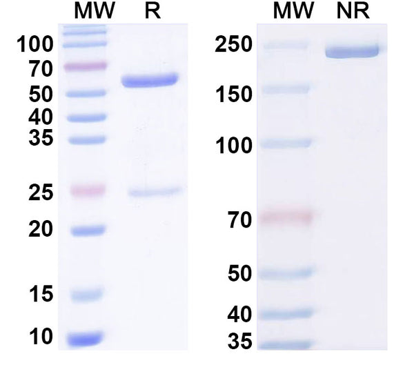 SDS-PAGE for Anti-Human CBX2 Antibody (SAA2130)