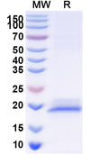 SDS-PAGE for Anti-Human TRIM28 Nanobody (SAA1235)
