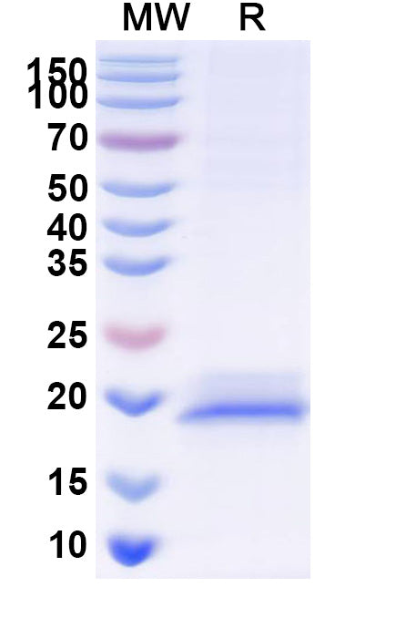 SDS-PAGE for Anti-Human TRIM28 Nanobody (SAA1235)