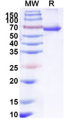 Recombinant Human SOS1 Protein, N-His