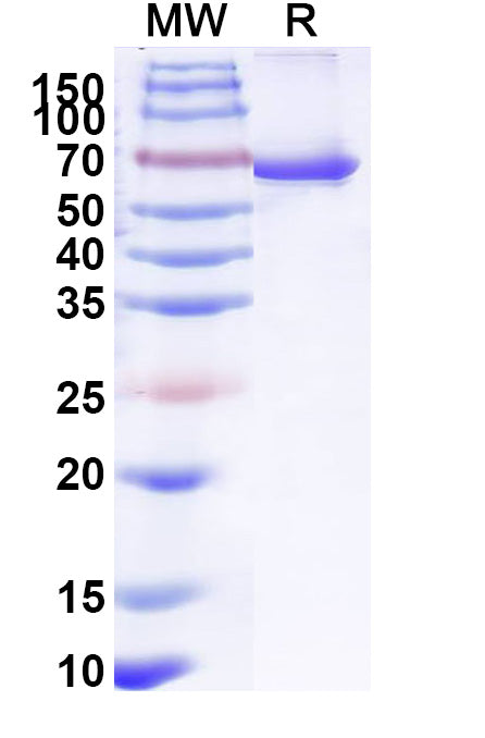 Recombinant Human SOS1 Protein, N-His