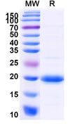 Recombinant Human SLC10A1 Protein, N-His-SUMO