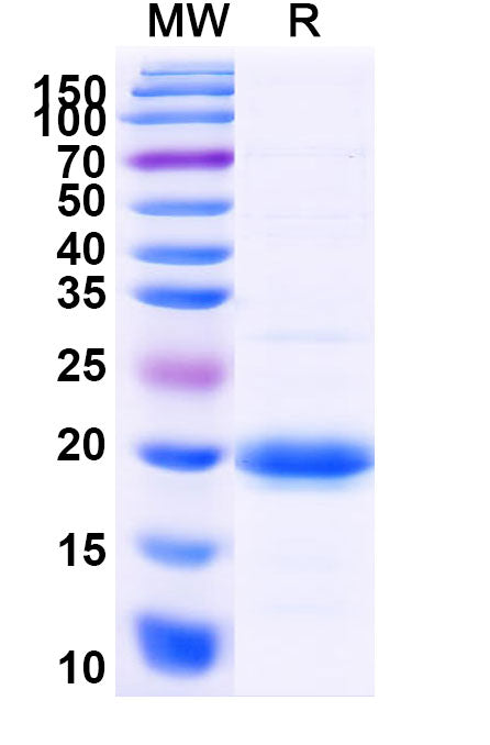 Recombinant Human SLC10A1 Protein, N-His-SUMO