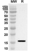Western blot analysis was performed using anti-Human IKZF1 polyclonal antibody at 1ug/mL on recombinant Human IKZF1 (Catalog No. HC436012).