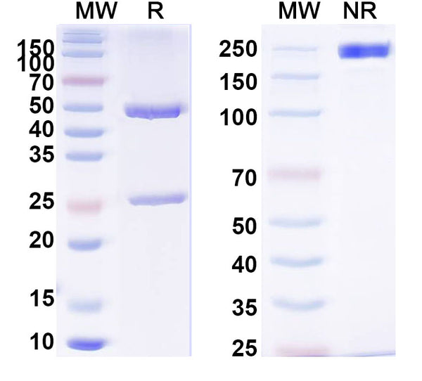 SDS-PAGE for Anti-Human TARDBP/TDP43 Antibody (3H)