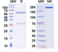 SDS-PAGE for Anti-TDP43 Antibody (L95A/42)