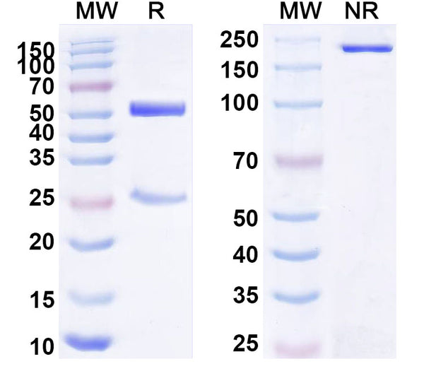 SDS-PAGE for Anti-Human APLP2 Antibody (SAA1796)