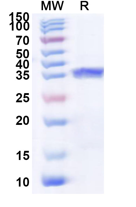 Recombinant Human GPR17 Protein, N-His-KSI