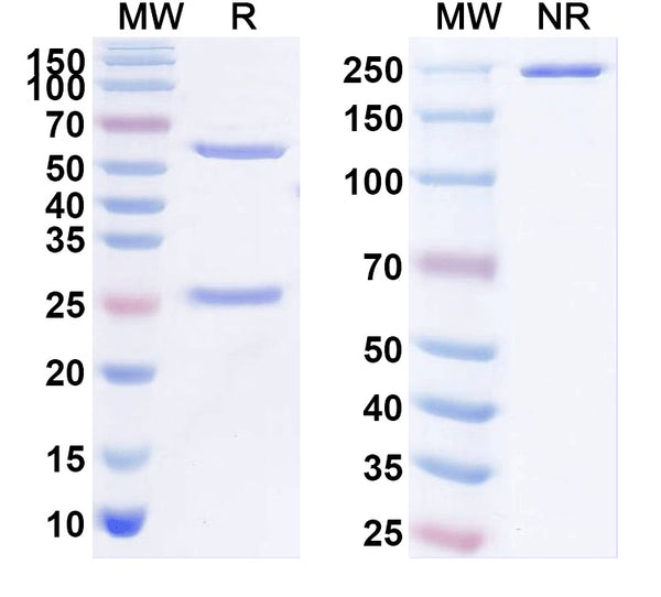 SDS-PAGE for Anti-Pan-Thyroid hormone receptor Antibody (N403/60)