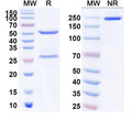SDS-PAGE for Anti-GluN1/NR1 glutamate receptor Antibody (N308/1)