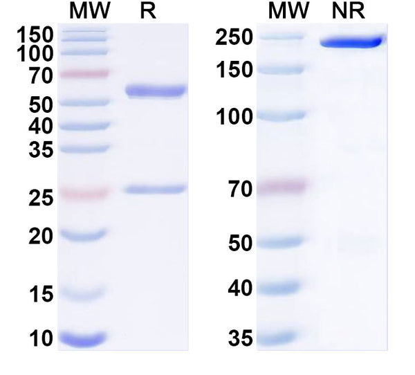 SDS-PAGE for Anti-Human PAPPA Monoclonal Antibody (1A406)