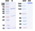 Anti-Human MSLN/Mesothelin Reference Antibody (RG7600) – Figure 1 of 1