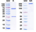 SDS-PAGE for Anti-Human MSLN/Mesothelin Antibody (K1)