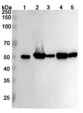 Western blot analysis was performed using anti-TUBB3 polyclonal antibody at 1ug/mL  on various samples.
Lane 1: N2A cell lysate
Lane 2: Mouse brain lysate
Lane 3: Mouse testis lysate
Lane 4: Rat brain lysate
Lane 5: Rat testis lysate