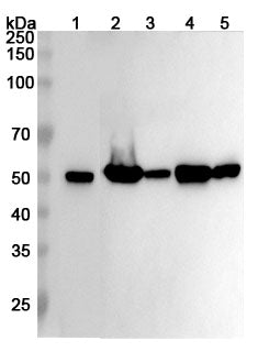 Western blot analysis was performed using anti-TUBB3 polyclonal antibody at 1ug/mL  on various samples.
Lane 1: N2A cell lysate
Lane 2: Mouse brain lysate
Lane 3: Mouse testis lysate
Lane 4: Rat brain lysate
Lane 5: Rat testis lysate