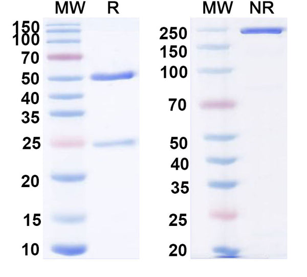 Anti-Human IL18/IL1F4 Reference Antibody (ABT-325) – Figure 1 of 1
