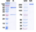 SDS-PAGE for Anti-Ankyrin-G Antibody (N106/20)
