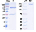 SDS-PAGE for Anti-Ankyrin-G Antibody (N106/65)