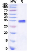 Recombinant Human ZBTB16 Protein, N-His