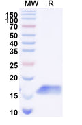 SDS-PAGE for Anti-Human CDH17/Cadherin-17 Nanobody (SAA1325)