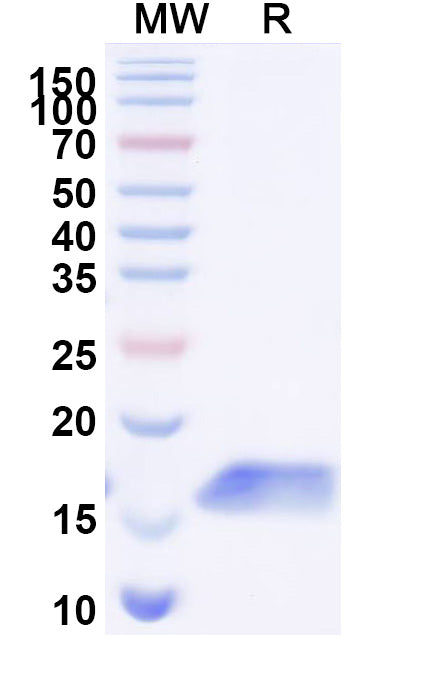 SDS-PAGE for Anti-Human CDH17/Cadherin-17 Nanobody (SAA1325)