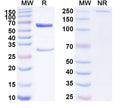 SDS-PAGE for Anti-Human AIMP1/EMAP-II Antibody (SAA1810)