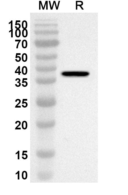 Western blot analysis was performed using anti-SEMA5A polyclonal antibody at 1ug/mL on recombinant SEMA5A (Catalog No. HC555012).
