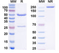 SDS-PAGE for Anti-Human ADAM15/MDC15 Antibody (SAA0494)
