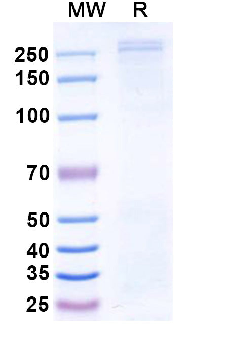 Recombinant Human CHD4 Protein, C-His