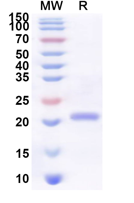 Recombinant Human ACVR2B Protein, N-His