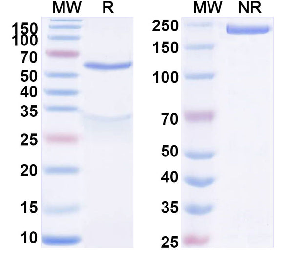 SDS-PAGE for Anti-Human ACVR2B Antibody (SAA1583)