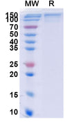 Recombinant Human CD213a2/IL13RA2 Protein, C-Fc