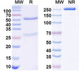 SDS-PAGE for Anti-Cav1.2 Ca2+ channel Antibody (N387/39)