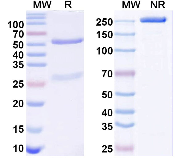 SDS-PAGE for Anti-Cav1.2 Ca2+ channel Antibody (N387/39)
