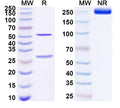 SDS-PAGE for Anti-Human AIMP2 Antibody (SAA1667)