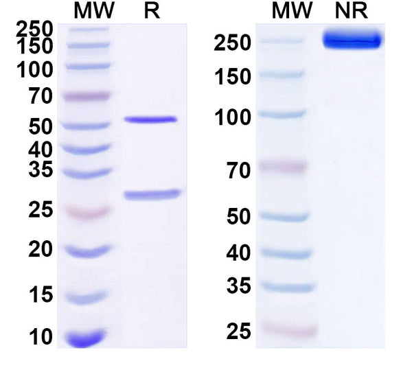 SDS-PAGE for Anti-Human AIMP2 Antibody (SAA1667)