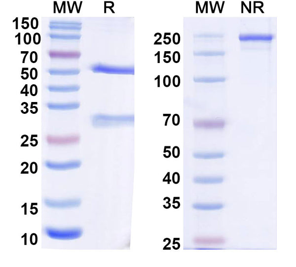 SDS-PAGE for Anti-Human IL11RA Antibody (8E4#)