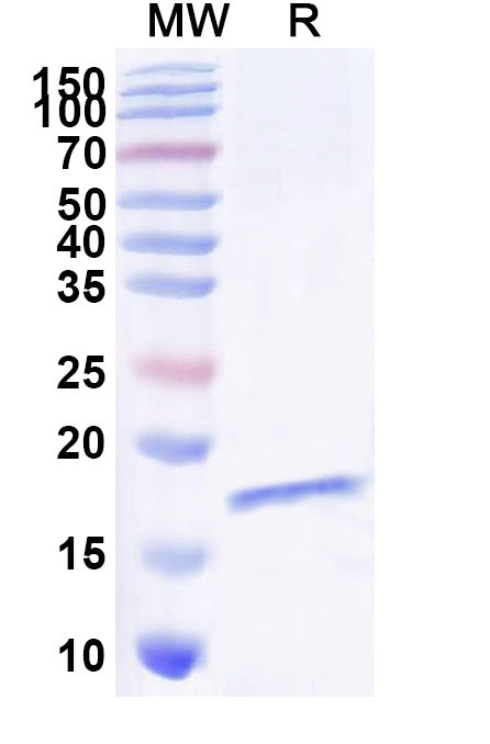 SDS-PAGE for Anti-Human CD136/MST1R/RON Nanobody (SAA1369)