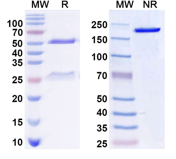 SDS-PAGE for Anti-KCC2 Antibody (N1/66)
