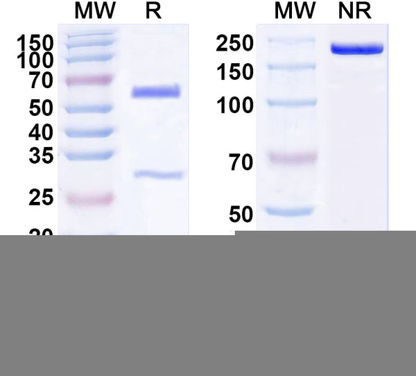 SDS-PAGE for Anti-Human BMPR2 Antibody (SAA1802)
